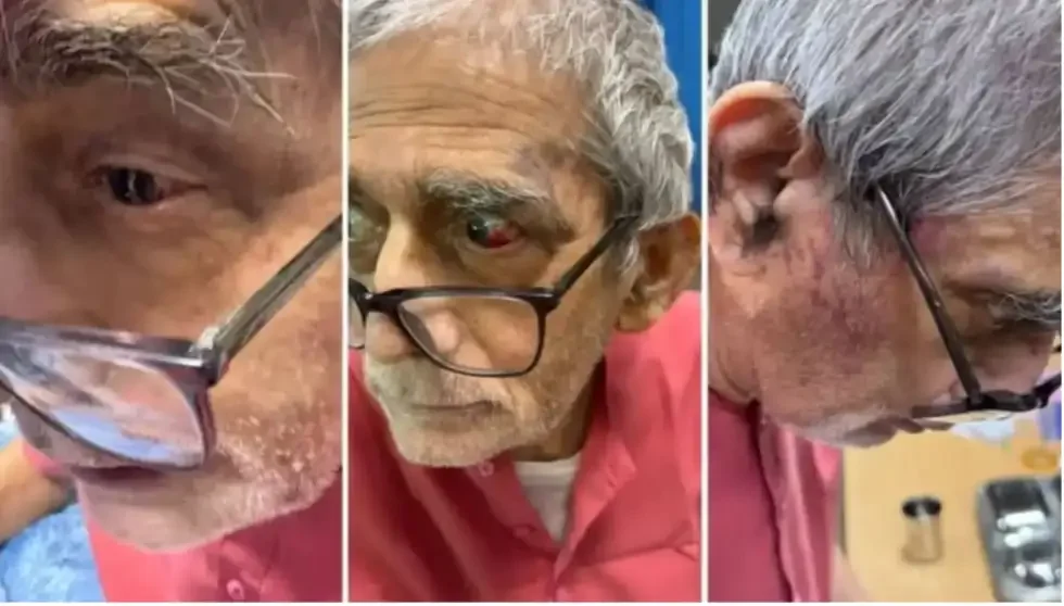 BHU में पद्मश्री डॉ. टीके लाहिड़ी से मारपीट: FIR में देरी पर गरमाई राजनीति, उठे गंभीर सवाल