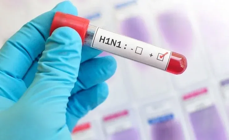 दिल्ली में स्वाइन फ्लू (H1N1) का बड़ा खतरा, 6 गुना बढ़े मामले; जानें लक्षण और बचाव के उपाय