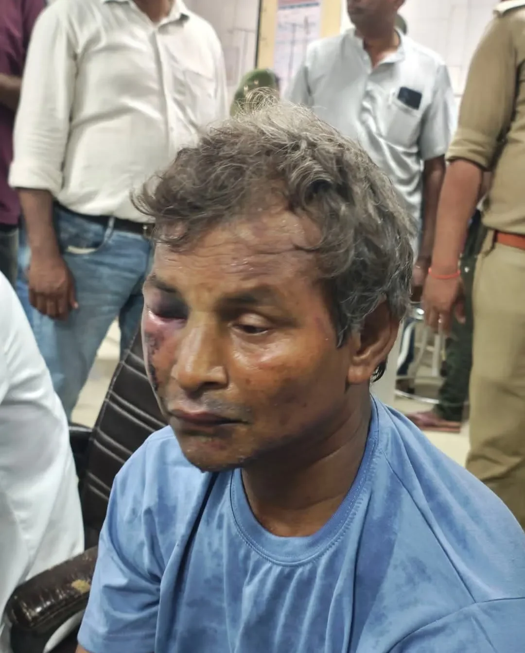 चंदौली मेंवानियत: टॉफी का लालच देकर डेढ़ साल की मासूम से दरिंदगी, आक्रोशित भीड़ ने आरोपी को पीटा